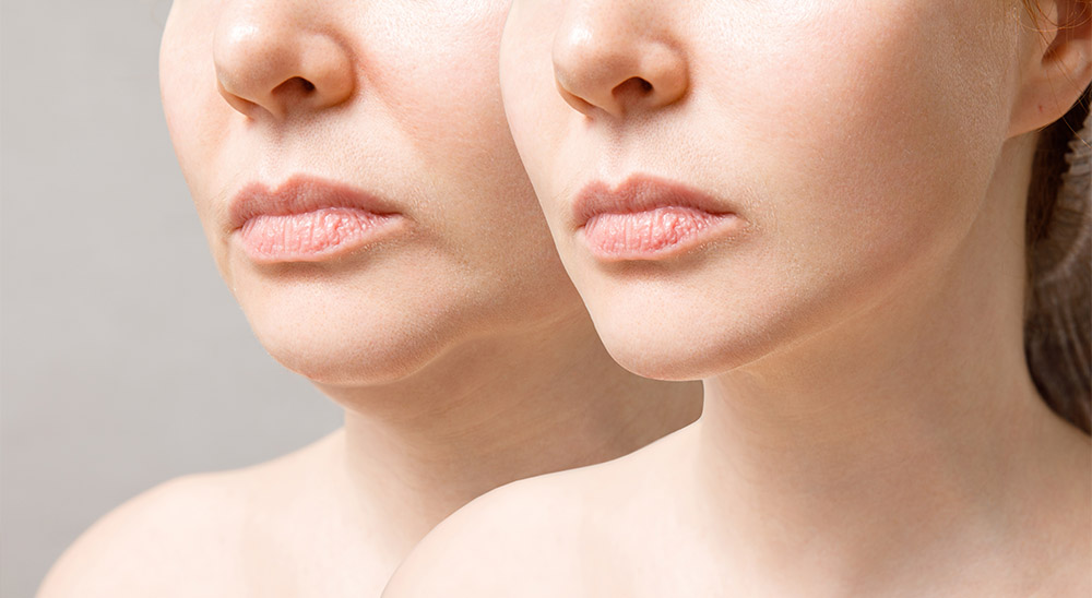 Seferis Plastic Surgery